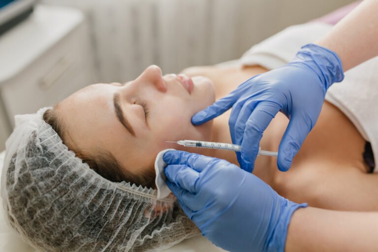 fillers σε μάγουλα και ζυγωματικά