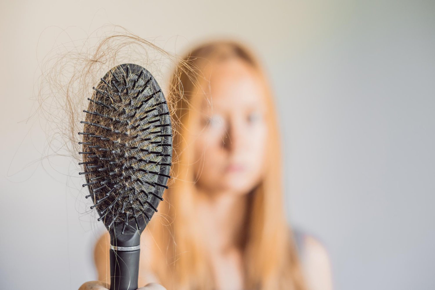 hair loss in women